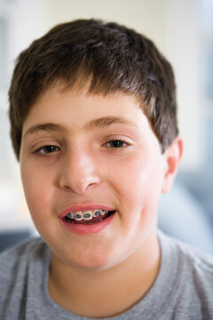 Portrait of a boy wearing braces.