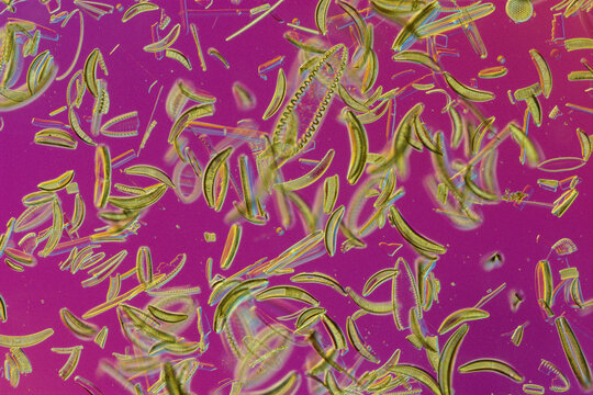 Close view of diatoms.; United States.