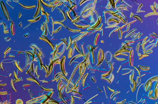 Microscopic view of diatoms.