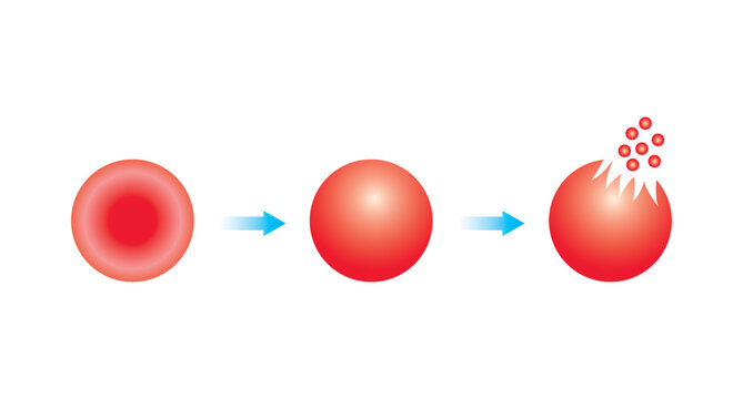 Scientific Designing Of Hemolysis. The Destruction Of Red Blood Cells. Colorful Symbols. Vector Illustration.