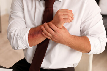 Man with bruise on arm in office