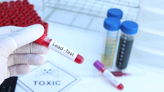 Lead test to look for abnormalities from blood,  blood sample to analyze in the laboratory