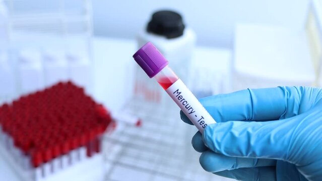 Mercury test to look for abnormalities from blood,  blood sample to analyze