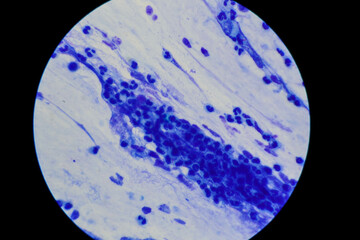 Mycobacterium tuberculosis appearance under the microscope is red with AFB staining