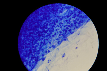 Mycobacterium tuberculosis appearance under the microscope is red with AFB staining