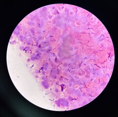 bacteria