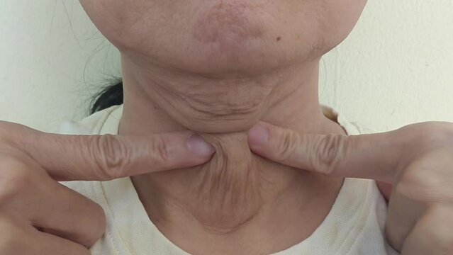 Middle-aged woman pulling wrinkles on her neck with her fingers.
