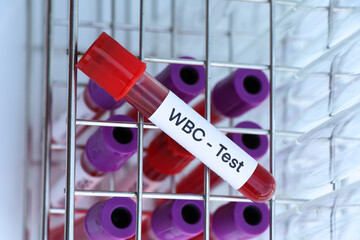 WBC test to look for abnormalities from blood