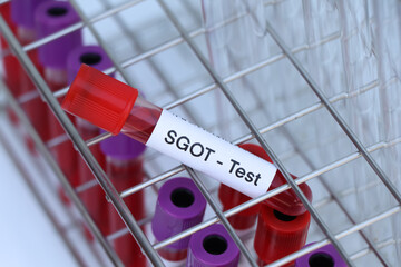 SGOT test to look for abnormalities from blood
