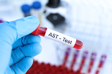 AST test to look for abnormalities from blood