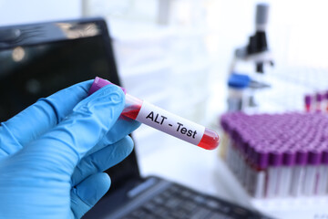 ALT test to look for abnormalities from blood