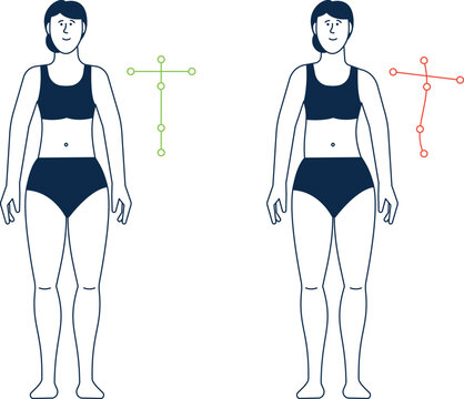 Wrong and right body posture. Woman spine aligment
