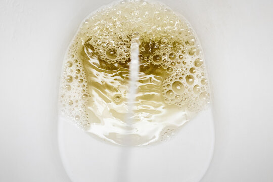 The lavatory in the toilet and the stream of urine during urination