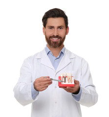 Dentist holding educational model of dental implant on white background