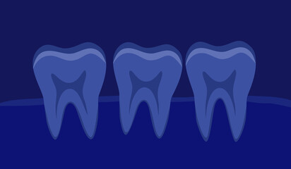 Teeth x-ray concept vector illustration. Dental radiological film in flat design.