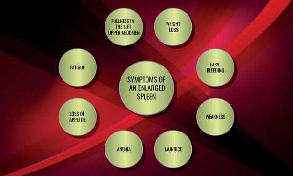 symptoms of  an enlarged spleen. Vector illustration for medical journal or brochure.