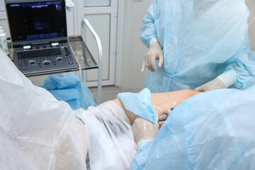Patient on operating table is covered with medical sheets, surgeon is preparing to insert a catheter into the leg. Process of surgery for the treatment of varicose veins with a modern method