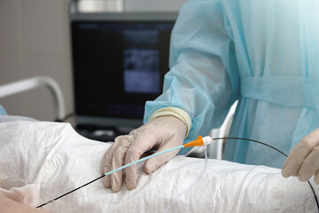 Vascular surgeon inserts catheter into vein treat varicose veins lower extremities cause diseased...