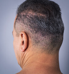 Fototapeta premium back of the head view fof a middle aged man