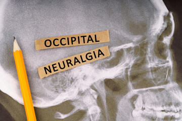 On x-rays of a human skull, a pencil and strips of paper with the inscription - Occipital neuralgia