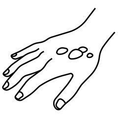 Obraz premium burns and scalds line icon