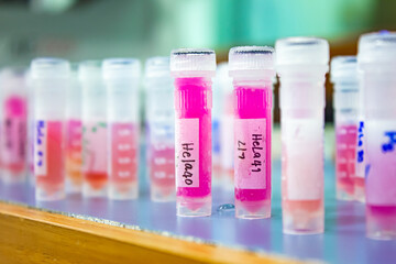 Closeup, cultures cancer cells in cryovial tubes taken from liquid nitrogen infusion to prepare drug tests for anticancer in the laboratory. Research and drug development, Medical, Pharmaceutical.