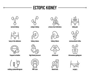 Ectopic Kidney symptoms, diagnostic and treatment vector icon set. Line editable medical icons.