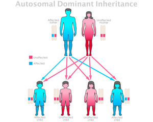 Autosomal dominant inheritance. Affected father, unaffected mother child, son, doughter. Red, blue dominance allele pattern recessive traits. Male, female human gene graph chart. Illustration vector