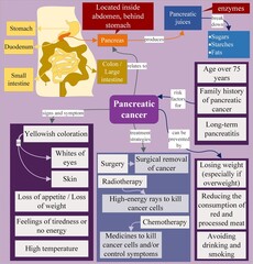 Pancreatic cancer is the cancer of pancreas