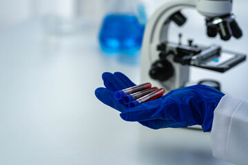 Professional doctor examining arterial blood sample, professional research in nurse with microscope...