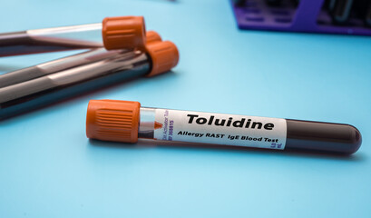 Toluidine  Allergy RAST IgE Blood Tests. Test tube on blue background