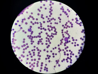 Colored blood smear sample under light microscope