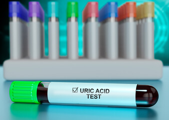 Human blood sample in the tube for testing uric acid levels