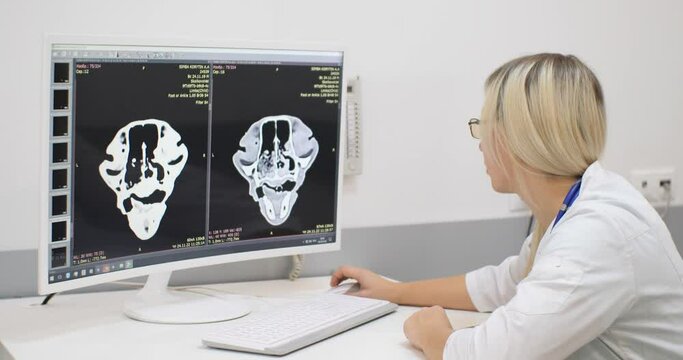 The doctor examines the pet's head on a computer monitor examined using magnetic resonance imaging. The veterinarian makes conclusions based on the results of the MRI examination.