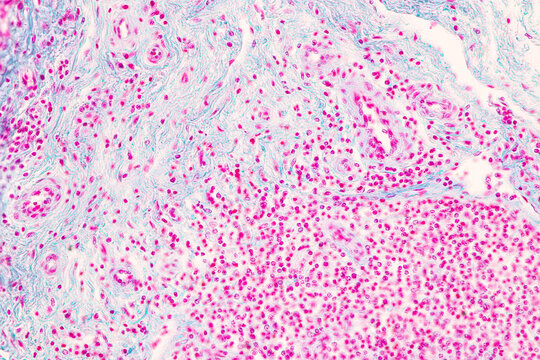 Backgrounds of Characteristics Tissue of Vagina Human under the microscope in Lab.