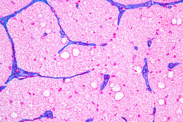 Characteristics Tissue of Optic nerve Human, Cornea from eye Human and Eyelid Human under the...