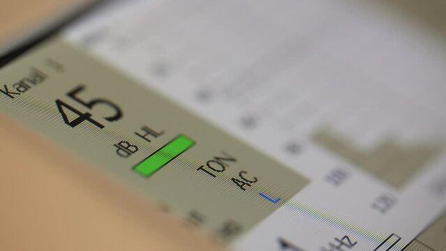 Hearing test device panel showing results of patient evaluation &ndash; close up 4k