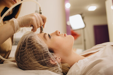 Obraz na płótnie Canvas Diamond microdermabrasion, peeling cosmetic. woman during a microdermabrasion treatment in beauty salon