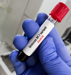Blood sample for Omicron BF.7 variant test. New variant of the SARS-CoV-2 coronavirus. Subvariant...