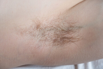 Female hairy armpit close up, body positive