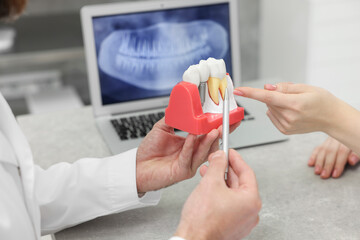 Doctor showing patient educational model of dental implant in clinic, closeup