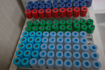 Blood sample tube from a shelf with analysis machines in the laboratory background. tubes prepared...