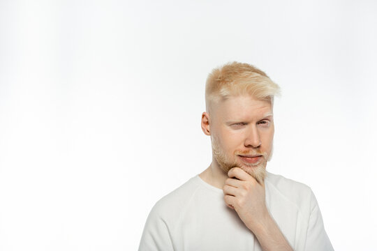 Pensive Albino Man Touching Beard While Thinking On White Background