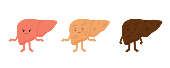 A healthy liver. Nonalcoholic fatty liver disease. Cirrhosis. Reversible and irreversible stages of liver diseases.