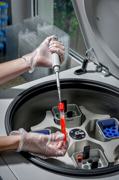 Lab technician works with a centrifuge in a hospital lab
