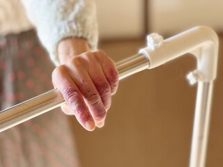 介護用手すりを持つ高齢女性の手