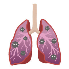 肺炎のイラスト