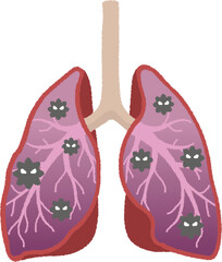 肺炎のイラスト