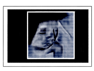 3Dエコー写真風のイラスト　頬杖をしている胎児