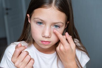 Little girl child putting contact lens into her eye closeup vision concept